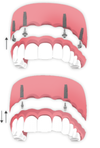 imp3-250x370